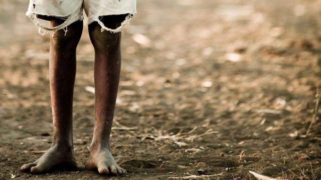 Tigray'da 5,2 milyon insan hayat kurtarıcı insani yardıma muhtaç